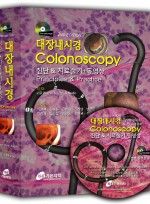 대장내시경 Colonoscopy : 진단 & 치료술기+동영상