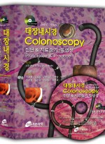 대장내시경 Colonoscopy : 진단 & 치료술기+동영상