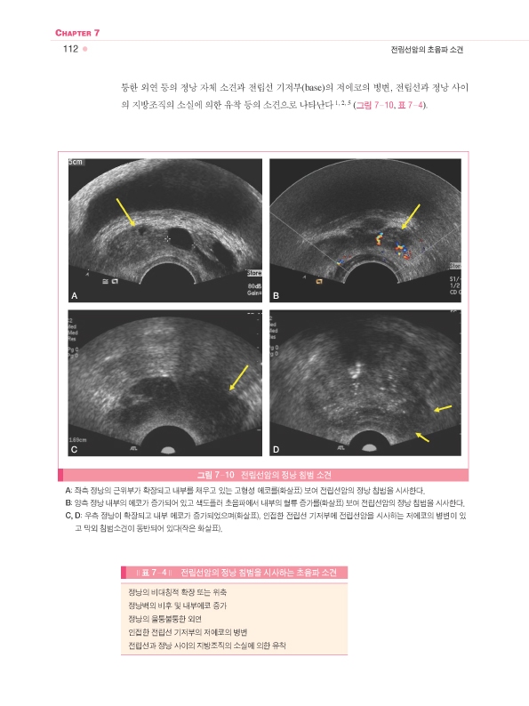 전립선질환의 영상 (전립선초음파와 영상)