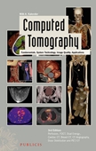 Computed Tomography,3/e: Fundamentals, System Technology, Image Quality, Applications