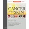 Cancer of the Skin,2/e