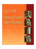 Imaging Painful Spine Disorders