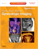 Gynecologic Imaging: Expert Radiology Series