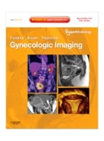 Gynecologic Imaging: Expert Radiology Series