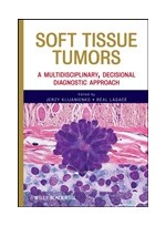 Soft Tissue Tumors: A Multidisciplinary, Decisional Diagnostic Approach