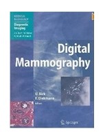 Digital Mammography (Paperback)