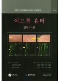 여드름 흉터 (진단/치료)   2판