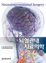 뇌혈관내치료의학