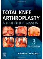 Total Knee Arthroplasty: A Technique Manual 3ED