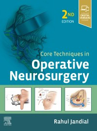 Core Techniques in Operative Neurosurgery 2e