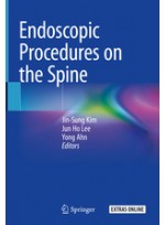 Endoscopic Procedures on the Spine