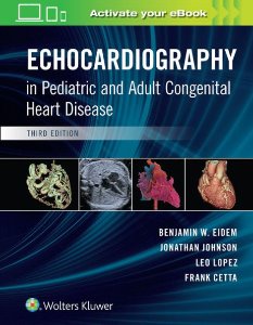 Echocardiography in Pediatric and Adult Congenital Heart Disease,3/e