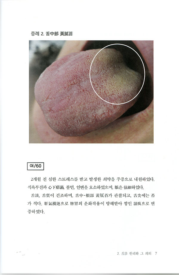 증례 사진으로 알아보는 설진 내과학