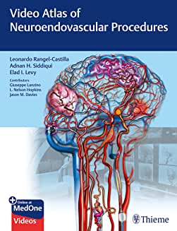 Video Atlas of Neuroendovascular Procedures 1/ed