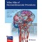 Video Atlas of Neuroendovascular Procedures 1/ed