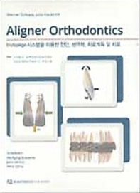 Aligner Orthodontics  Invisalign 시스템을 이용한 진단 생역학 치료계획 및 치료