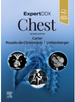 ExpertDDx: Chest 2e