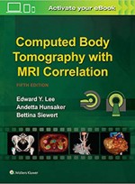 Computed Body Tomography with MRI Correlation 5e