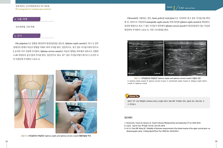 쉽게 배우는 근근막통증증후군 TPI치료법