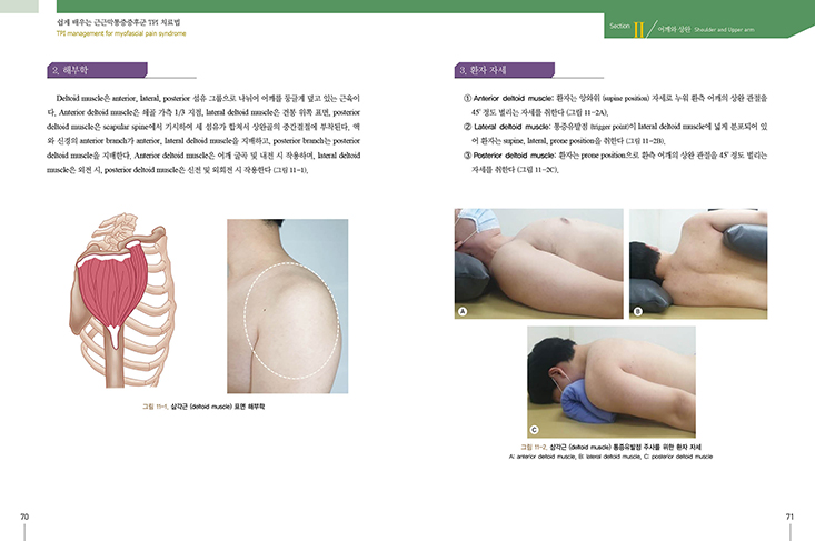 쉽게 배우는 근근막통증증후군 TPI치료법