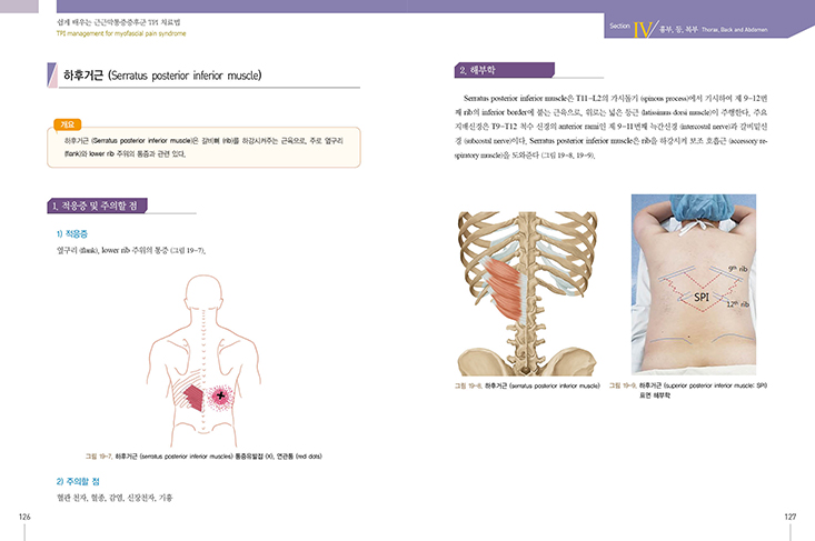 쉽게 배우는 근근막통증증후군 TPI치료법