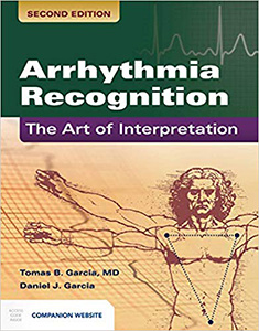 Arrhythmia Recognition: The Art of Interpretation 2e