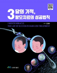 3달의 기적, 탈모치료의 성공 법칙