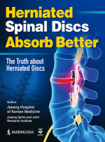 Herniated Spinal Discs Absorb Better