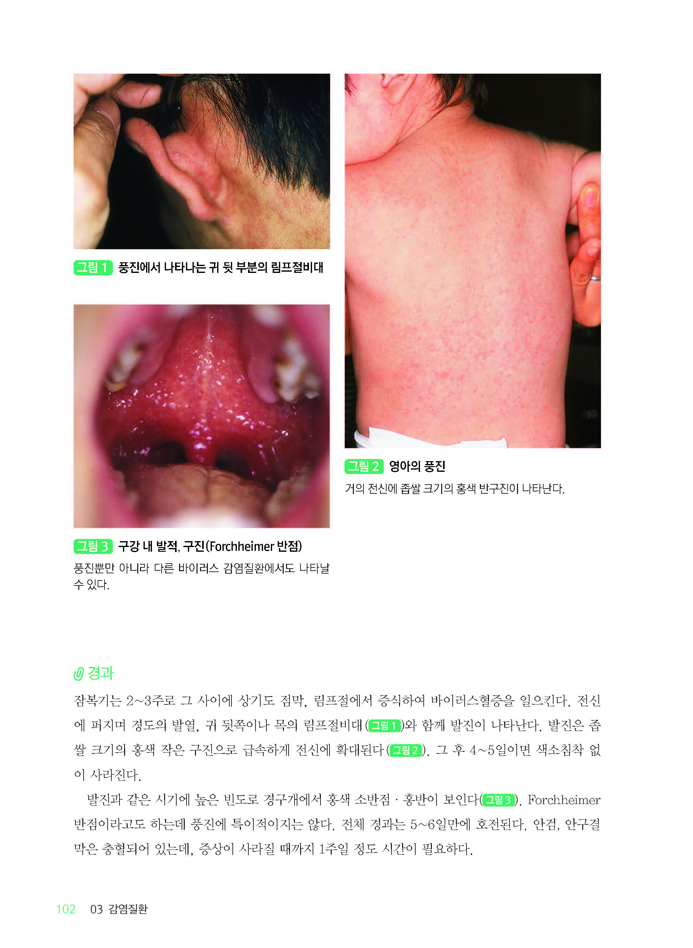 진료실에서 흔히 접하는 소아청소년 피부질환