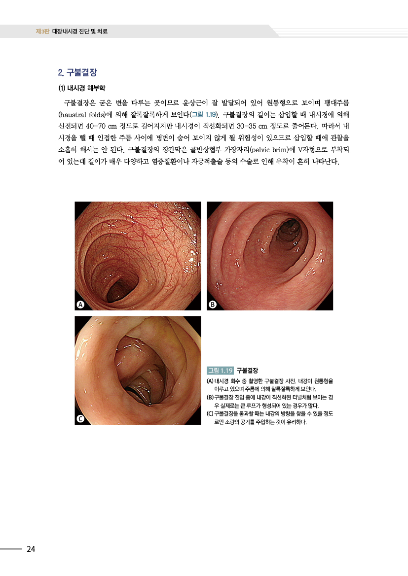 대장내시경 진단 및 치료 3판