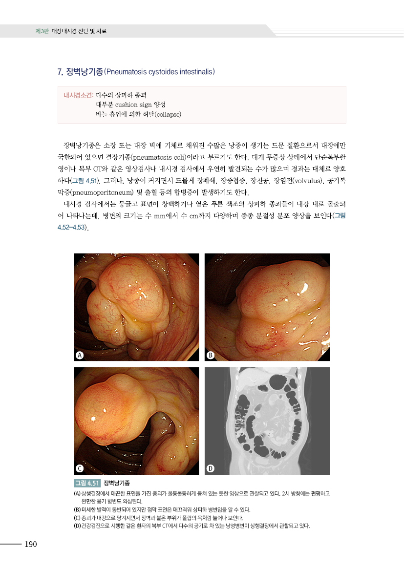 대장내시경 진단 및 치료 3판