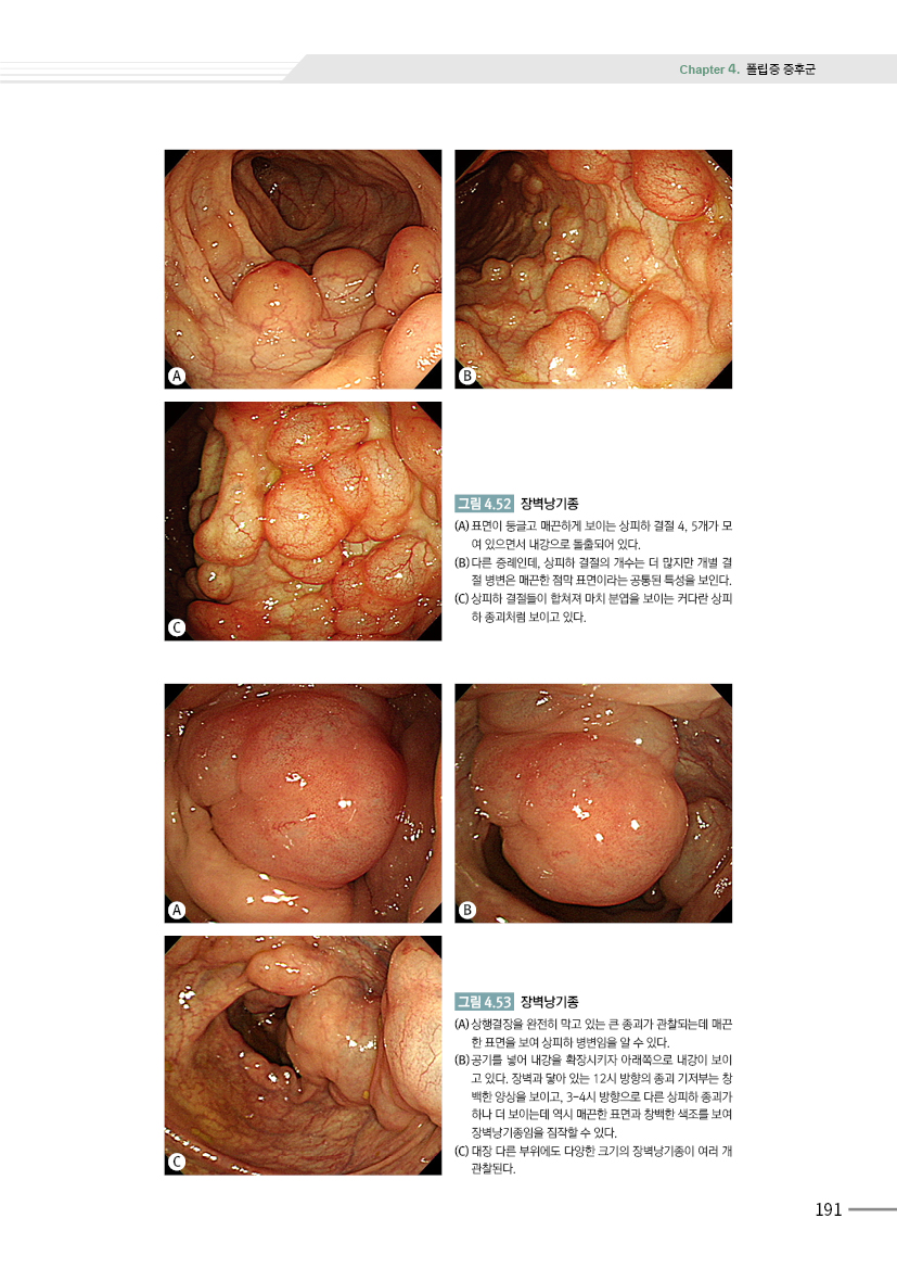 대장내시경 진단 및 치료 3판