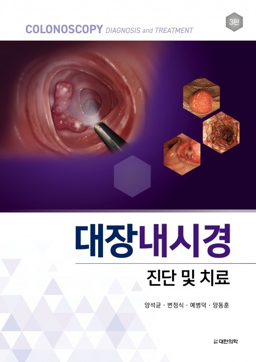 대장내시경 진단 및 치료 3판