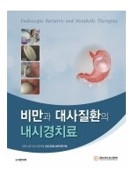 비만과 대사질환의 내시경치료