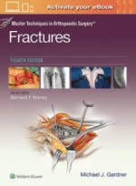 Master Techniques in Orthopaedic Surgery: Fractures, 4ED