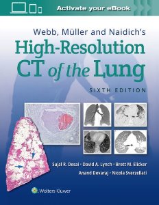 Webb, Müller and Naidich's High-Resolution CT of the Lung,6/e