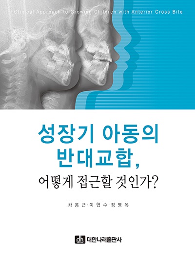 성장기 아동의 반대교합, 어떻게 접근할 것인가?