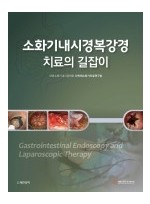 소화기내시경복강경 치료의 길잡이