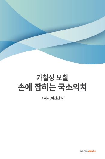 손에 잡히는 국소의치 - 가철성 보철