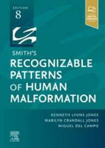 Smith's Recognizable Patterns of Human Malformation, 8e