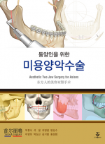 동양인을 위한 미용양악수술