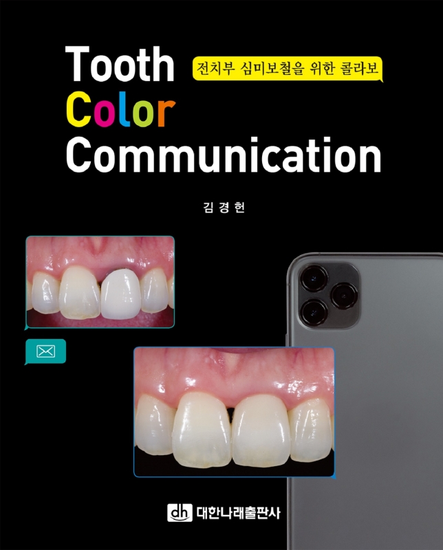 Tooth Color Communication [전치부 심미보철을 위한 콜라보]