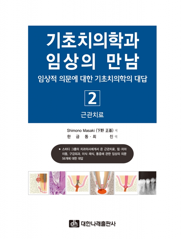 기초치의학과 임상의 만남 2-근관치료