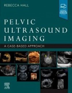 Pelvic Ultrasound Imaging, 1st Edition