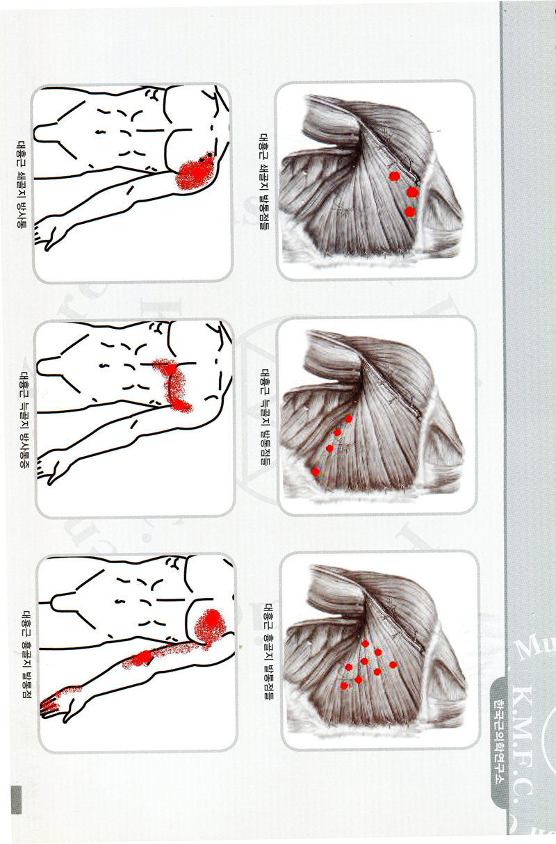 통증부위별 근육모음집