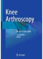 Knee Arthroscopy: An Up-to-Date Guide