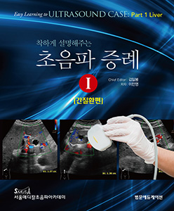 착하게 설명해주는 초음파 증례I - 간질환편