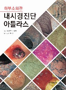 상부소화관 내시경진단 아틀라스