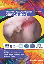 Cervical Spine (Contemporary Endoscopic Spine Surgery)