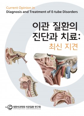 이관 질환의 진단과 치료: 최신 지견